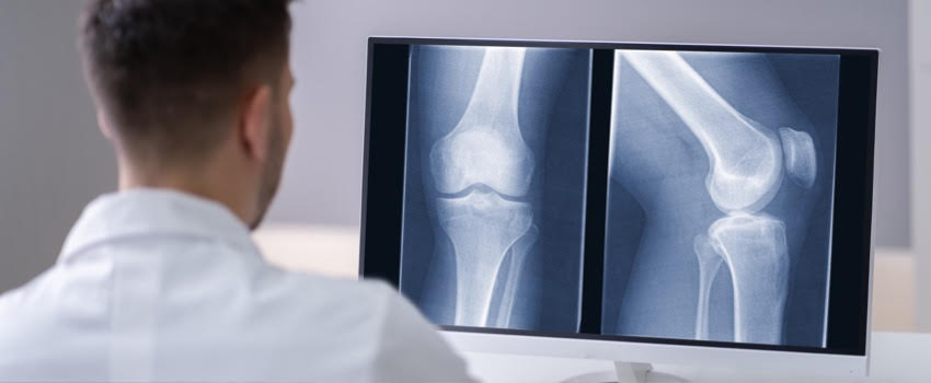 Why Does AFC Use Digital X-rays?