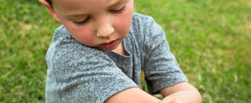 What Bug Bites Are Common in the Summer?