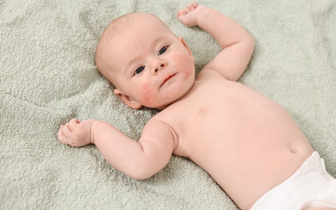 Can Babies Have Seasonal Allergies?