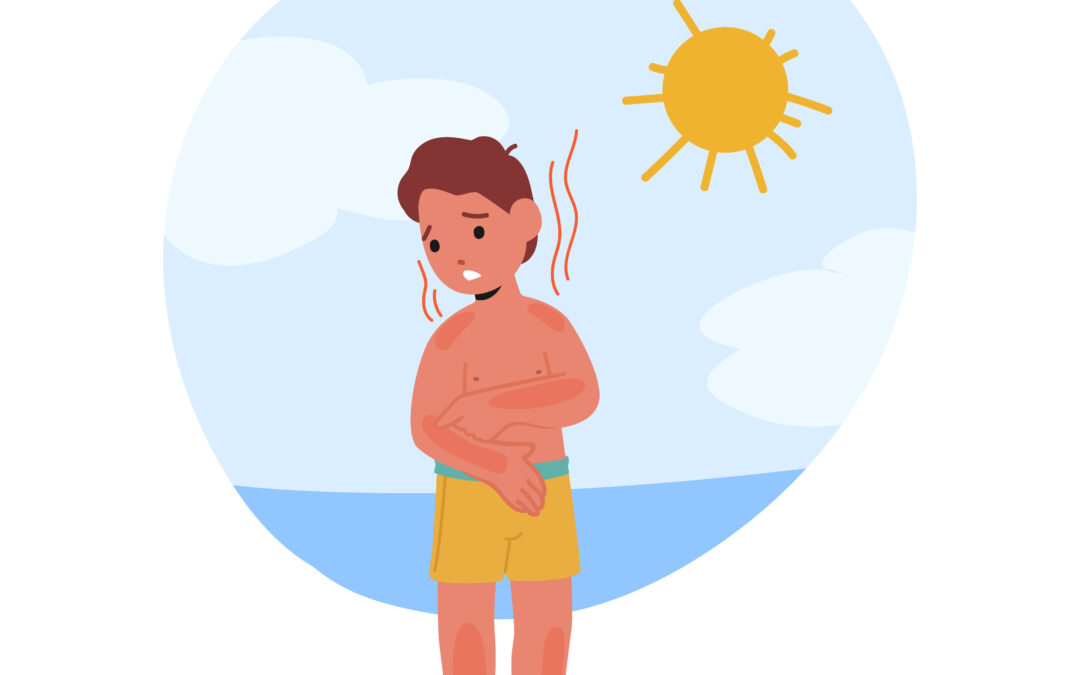 Is It Sun Poisoning or Just a Bad Burn? When to See a Provider
